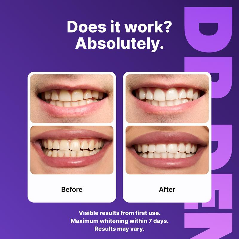 Purple Teeth Whitening Strips - 7/21 Whitening Sessions - Safe for Enamel - Non Sensitive Teeth Whitening
