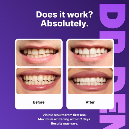 Purple Teeth Whitening Strips - 7/21 Whitening Sessions - Safe for Enamel - Non Sensitive Teeth Whitening